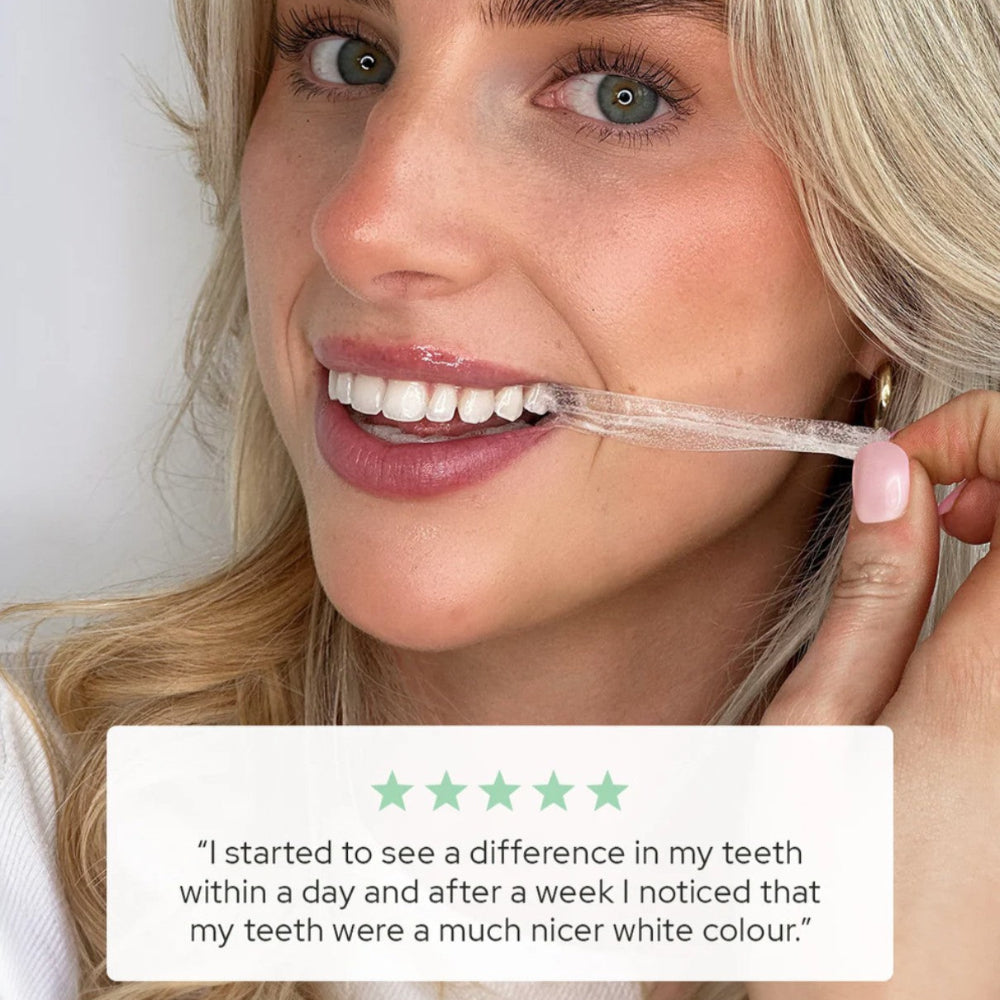 Spotlight Oral Care Ultra Teeth Whitening Strips 7 Day Supply